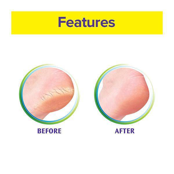 Krack Heel Repair Cream 25 gm - ANJANI MEDICAL